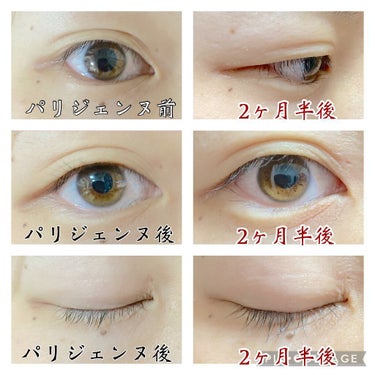 みるりあ🐈フォロバ100% on LIPS 「1/15にモデルとして、パリジェンヌをやってもらい、2ヶ月半経..」（2枚目）