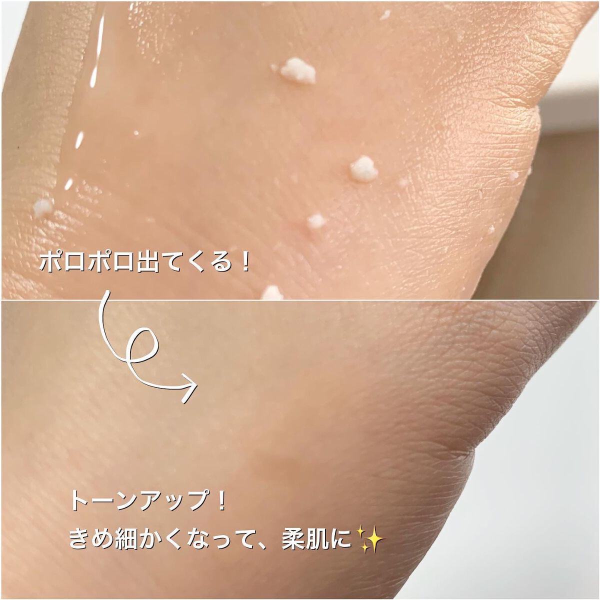 美白乃美人ピーリングジェル/ブレーンコスモス/ピーリングを使ったクチコミ(2枚目)