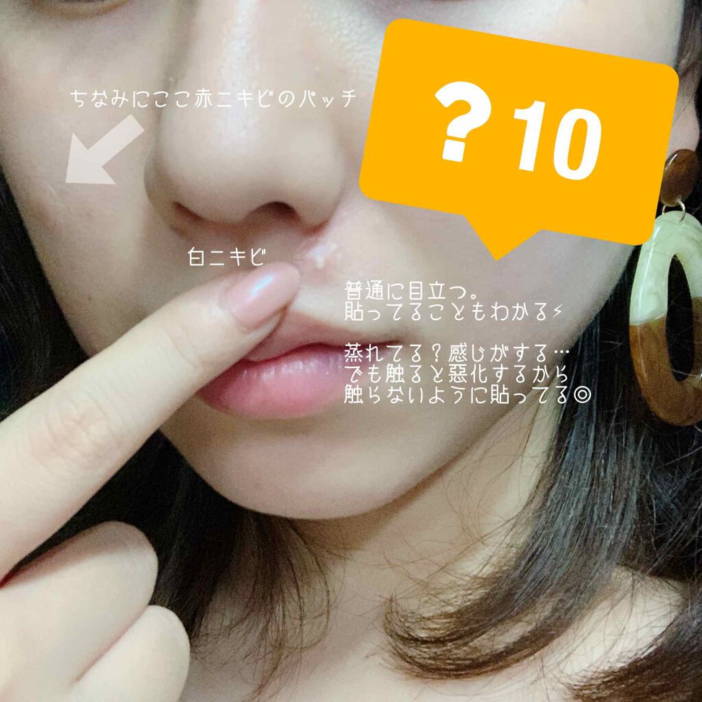 ゼロスポットパッチ/Today’s Cosme/にきびパッチを使ったクチコミ(3枚目)