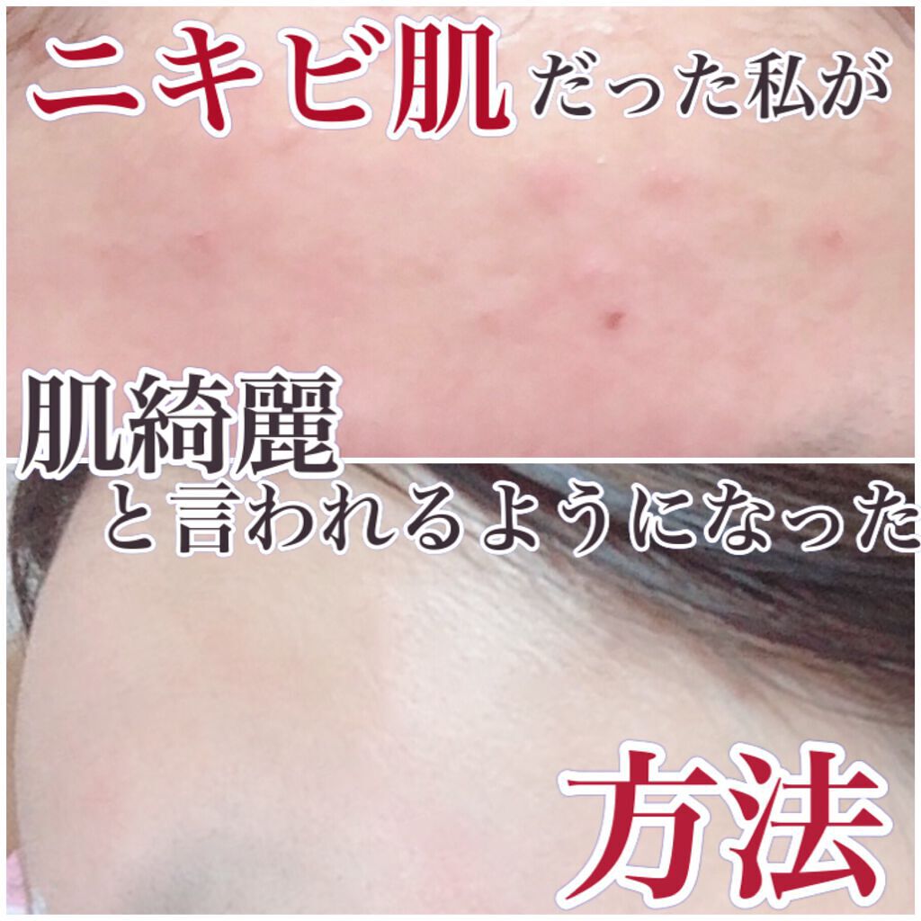 美白化粧水 VC/ちふれ/化粧水を使ったクチコミ(1枚目)