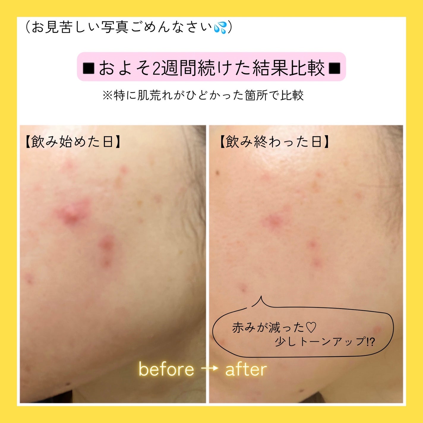 ビタミンC「2000」(医薬品)/武田薬品工業/健康サプリメントを使ったクチコミ(3枚目)