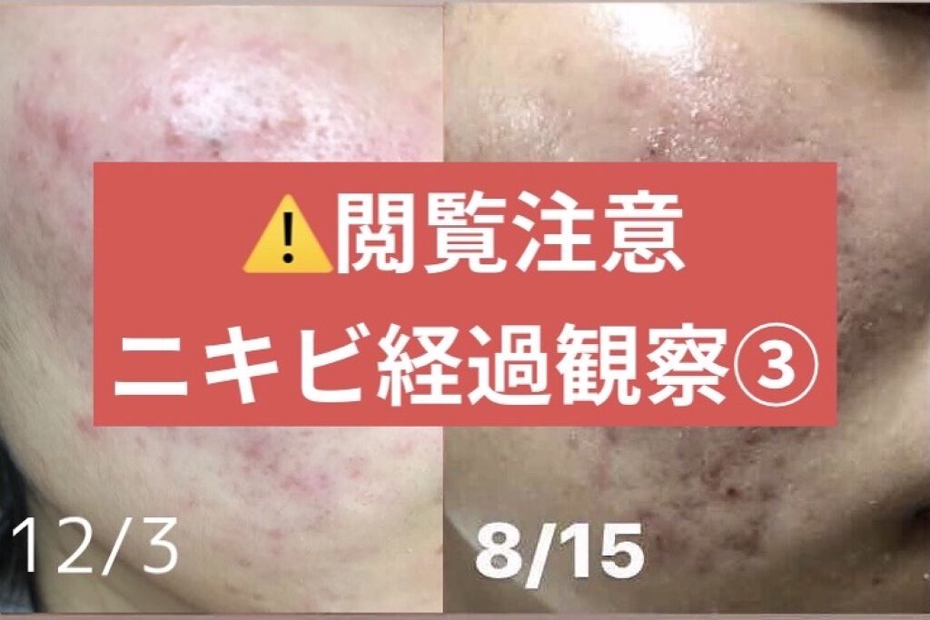 極潤ヒアルロン液（ハダラボモイスト化粧水d）/肌ラボ/化粧水を使ったクチコミ（1枚目）