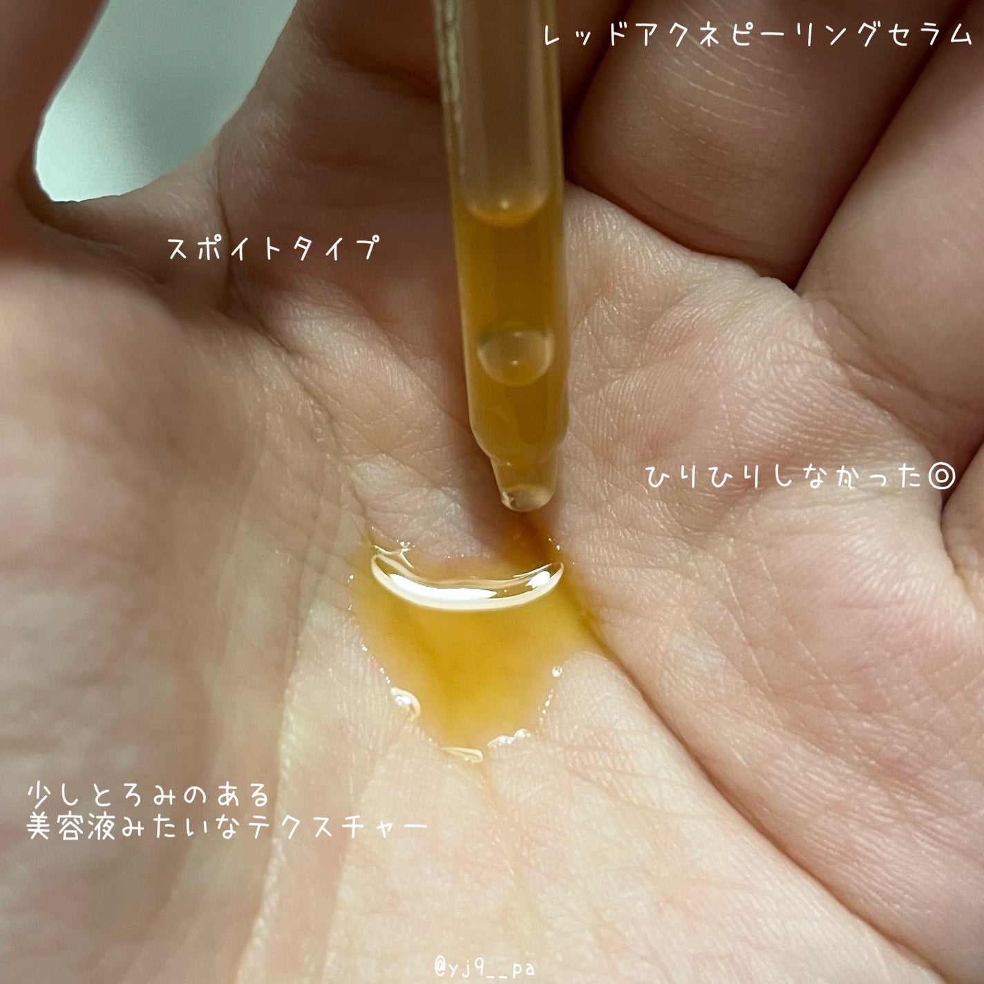 レッドアクネピーリングセラム/MEDICUBE/美容液を使ったクチコミ(3枚目)