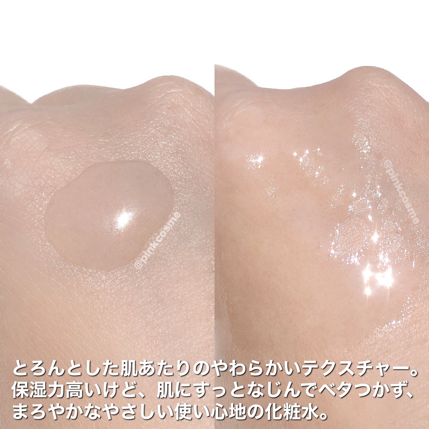 薬用高保湿化粧水/乾燥さん/化粧水を使ったクチコミ(5枚目)