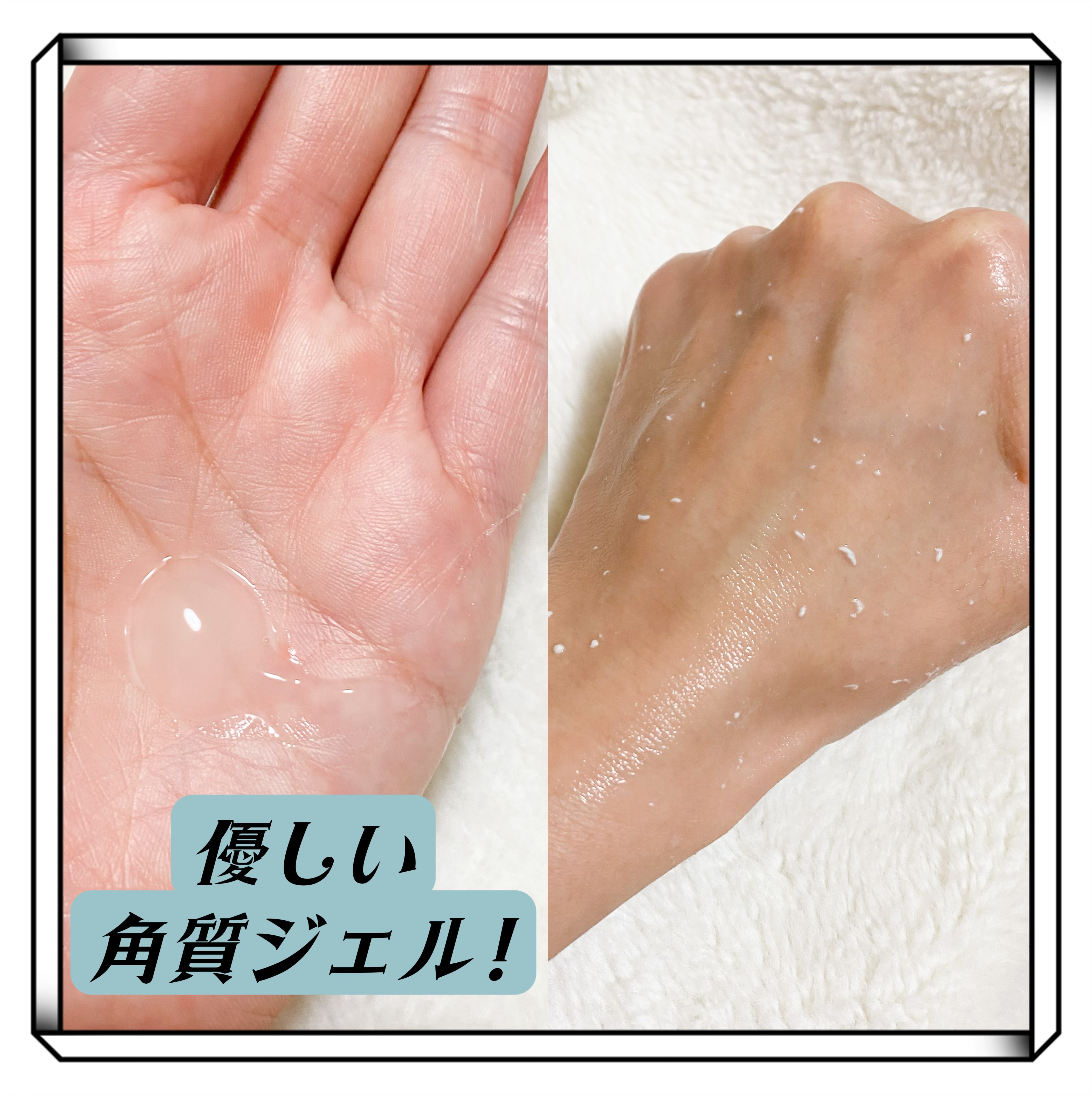 薬用アクネ角質ケアジェル/NIKI PITA/ピーリングを使ったクチコミ（2枚目）