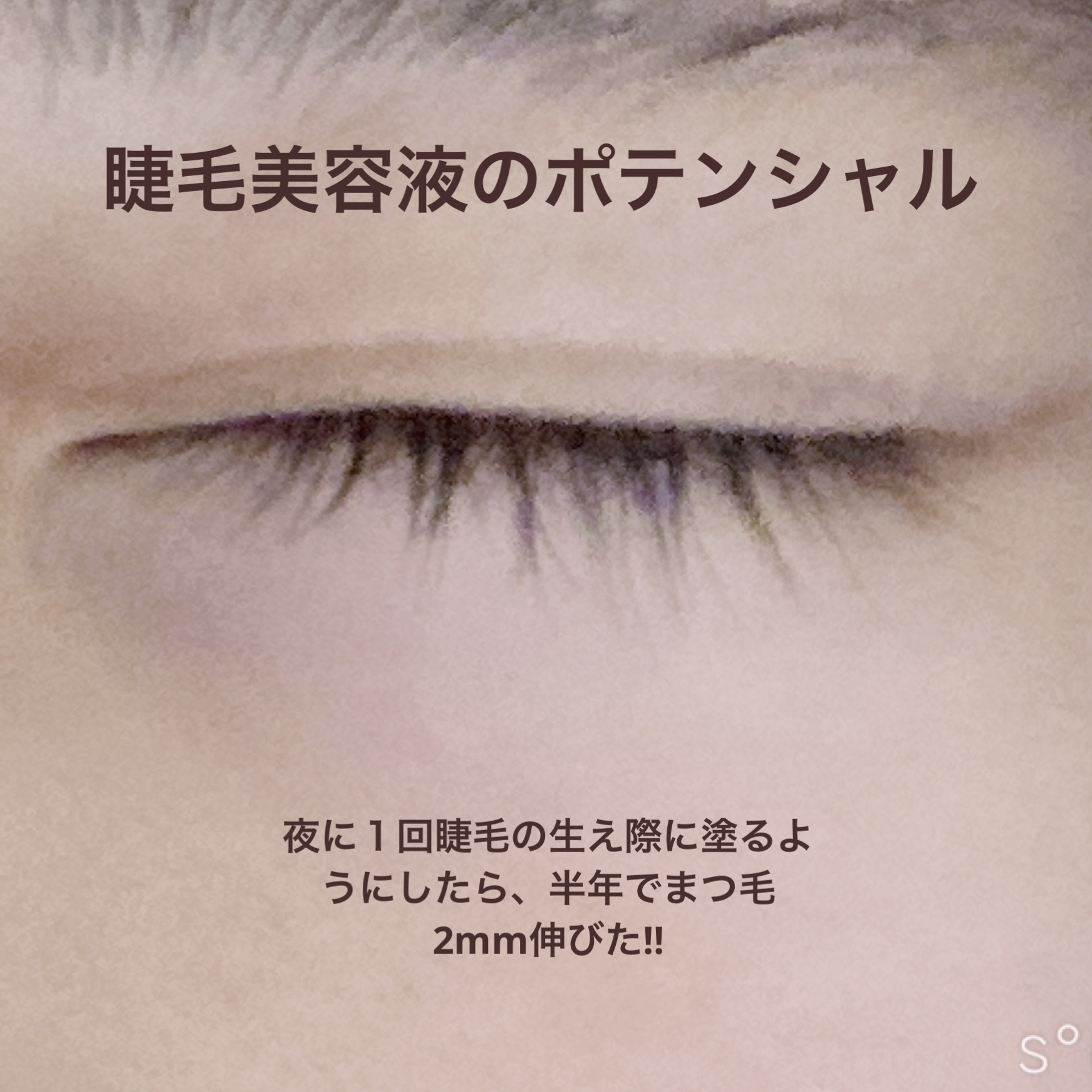 ローヤルゼリー配合 栄養ローション/DAISO/美容液を使ったクチコミ（3枚目）