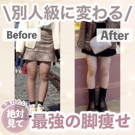 薬用しみ対策 美白化粧水/メラノCC/化粧水を使ったクチコミ(1枚目)