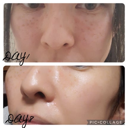 ビタペアC ビタレチ美容液/ネイチャーリパブリック/美容液を使ったクチコミ(2枚目)