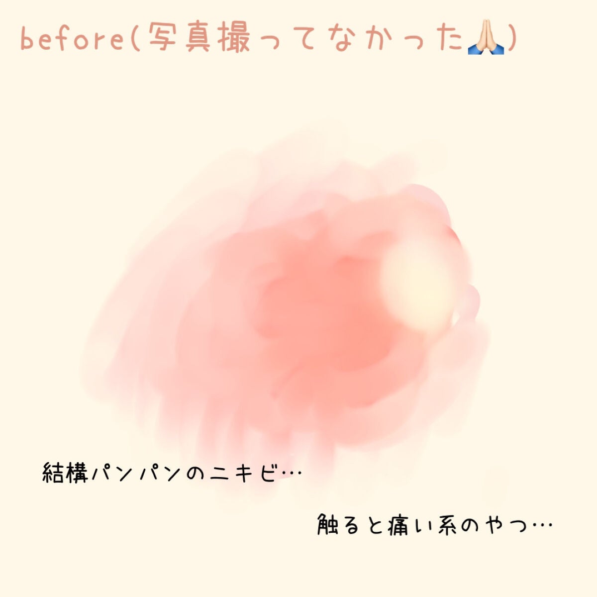 テラ・コートリル 軟膏(医薬品)/ジョンソン・エンド・ジョンソン/その他を使ったクチコミ(2枚目)