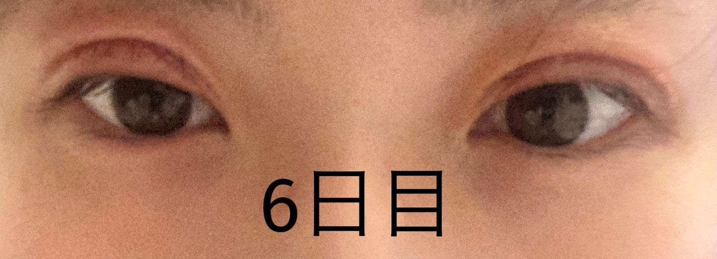 ãããœãð¡ãã©ãã100 on LIPS ãâïžäºéåéã¬ããããŠã³ã¿ã€ã ã6æ¥ç®è
«ãâãŸããŸãèªç¶ã«ãªã£..ãïŒ2æç®ïŒ