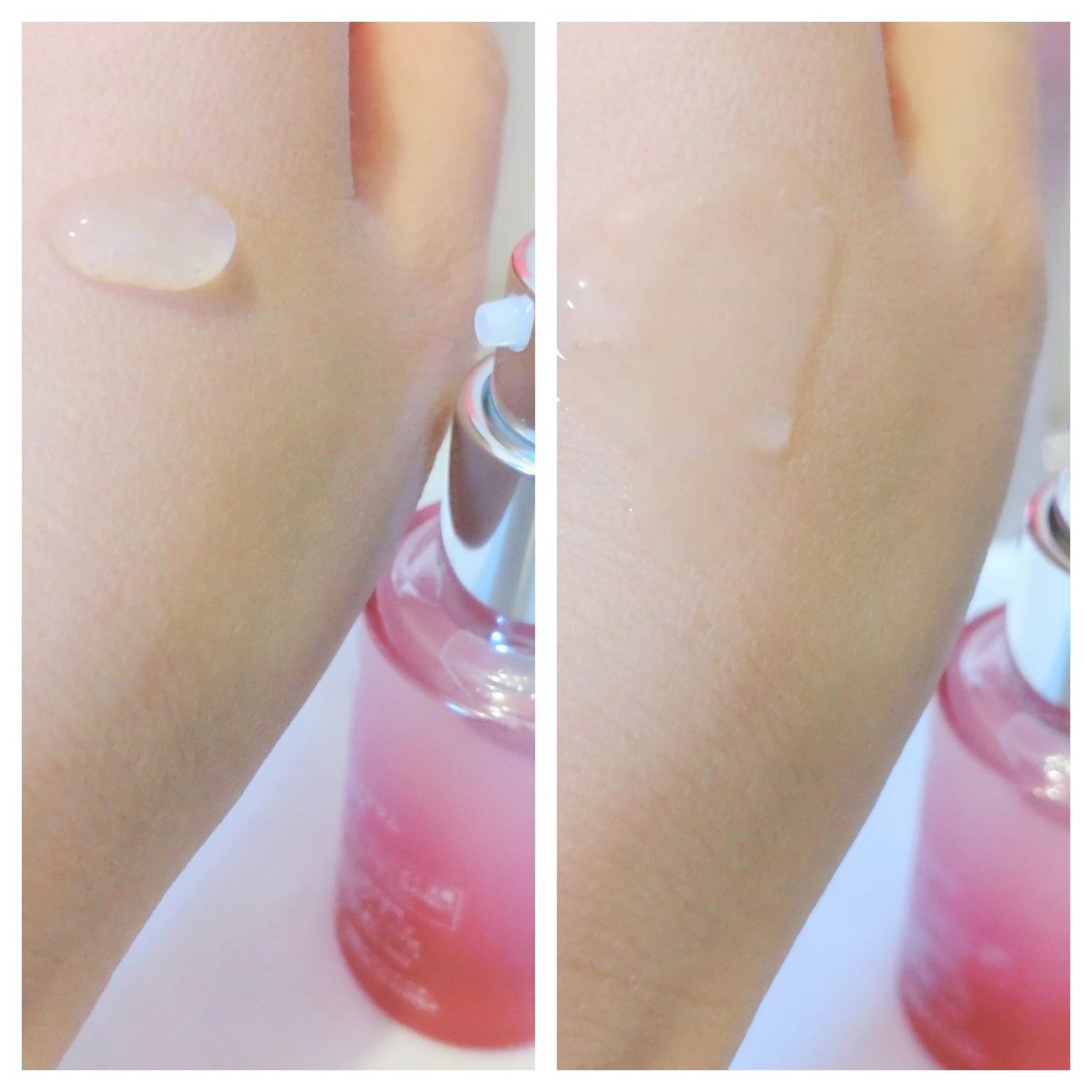 ブレミッシュケアアップ セラム/ISOI/美容液を使ったクチコミ(2枚目)