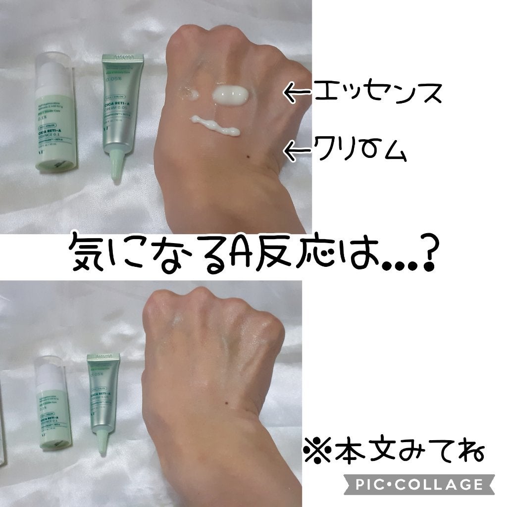 シカレチA エッセンス0.1/VT/美容液を使ったクチコミ(4枚目)
