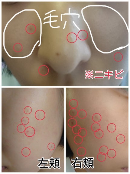 ハトムギ保湿ジェル(ナチュリエ スキンコンディショニングジェル)/ナチュリエ/美容液を使ったクチコミ(2枚目)