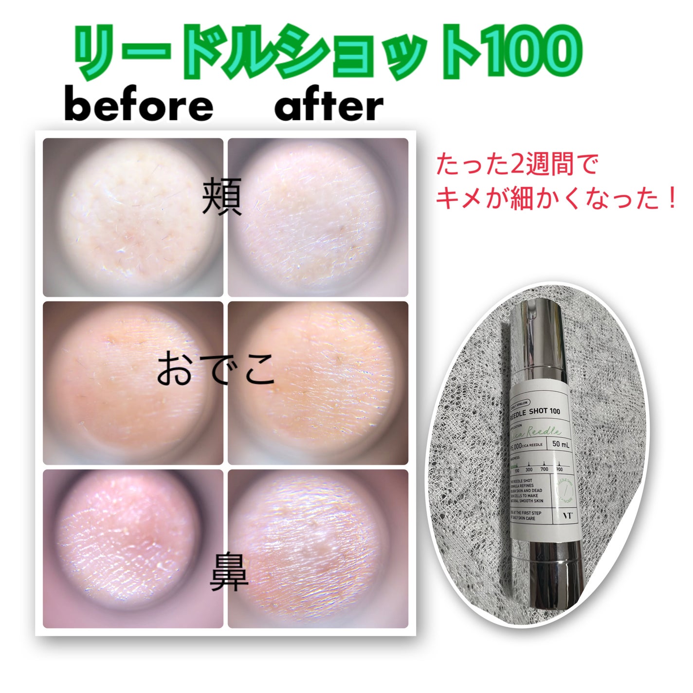 リードルショット100/VT/美容液を使ったクチコミ(2枚目)