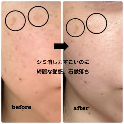 &be ファンシーラー/&be/パレットコンシーラーを使ったクチコミ(2枚目)