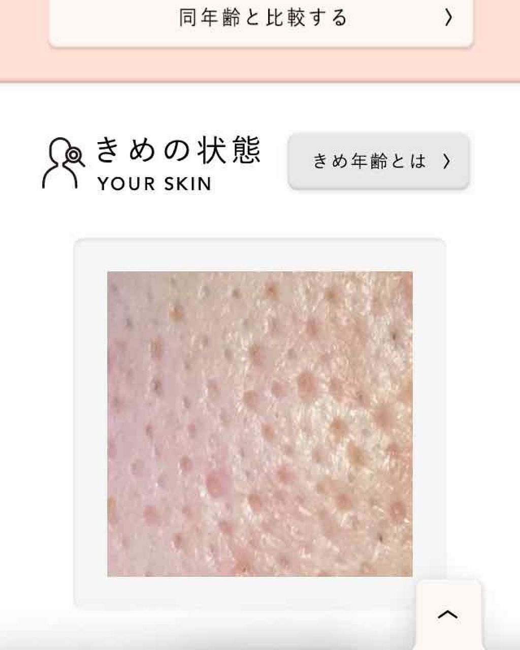 こーちゃん on LIPS 「肌が蓮コラみたいな毛穴でもうどうにもならん…😢なんかないかな、..」(1枚目)