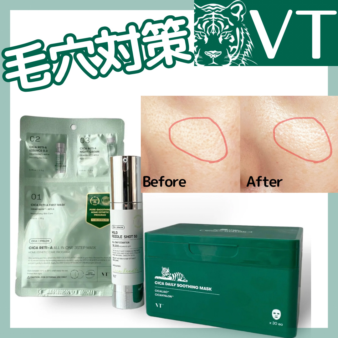 CICA デイリースージングマスク/VT/シートマスク・パックを使ったクチコミ（1枚目）