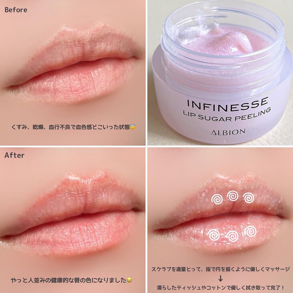 アンフィネス リップ シュガーピーリング/ALBION/リップスクラブを使ったクチコミ(5枚目)
