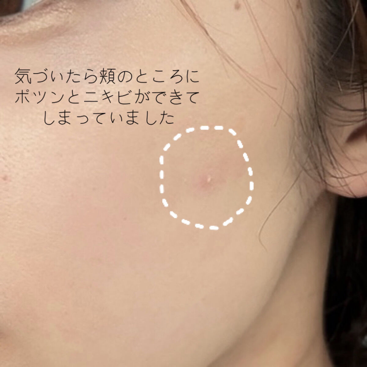 薬用しみ集中対策 プレミアム美容液/メラノCC/美容液を使ったクチコミ（2枚目）