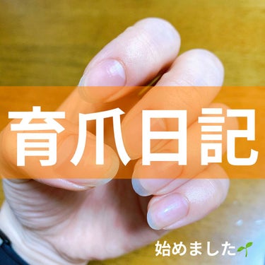 【自分用メモ】
育爪日記
撮影日 2021/7/29
測定日 2021/8/2

右手▶️親指1.4cm
               人差し指  1.2cm
               中指  1.