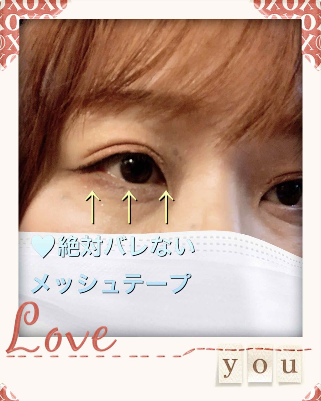 のびーるアイテープ(絆創膏タイプ、レギュラー)/DAISO/二重まぶた用アイテムを使ったクチコミ(1枚目)