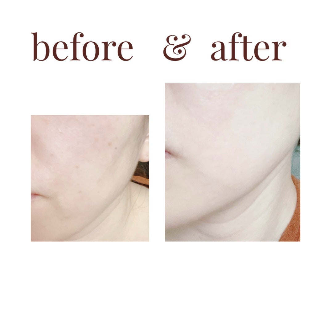 レチノール スーパーバウンス セラム/IOPE/美容液を使ったクチコミ(4枚目)