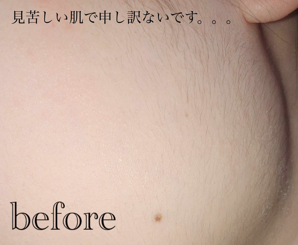 bi-hada ompa L ホルダー替刃2個付 通常デザイン/貝印/シェーバーを使ったクチコミ（3枚目）