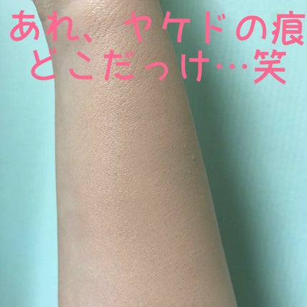 エイプリルスキン パーフェクトマジックカバーフィットクッション/APRILSKIN/クッションファンデーションを使ったクチコミ(4枚目)