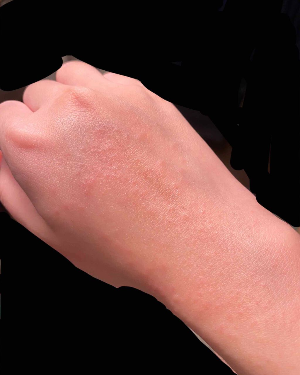 除毛クリーム/エピラット/除毛クリームを使ったクチコミ(2枚目)