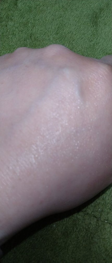 シカレチA クリーム0.05/VT/フェイスクリームを使ったクチコミ(8枚目)