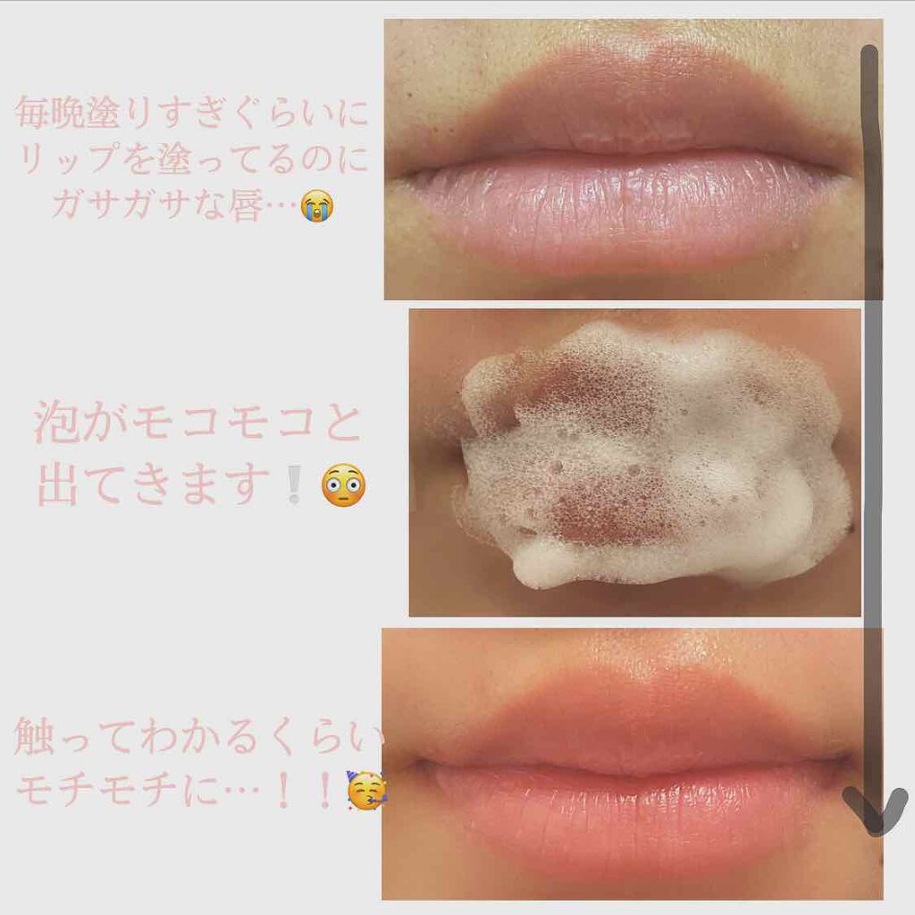 リップバブルパック/CHOOSY/リップマスクを使ったクチコミ(4枚目)