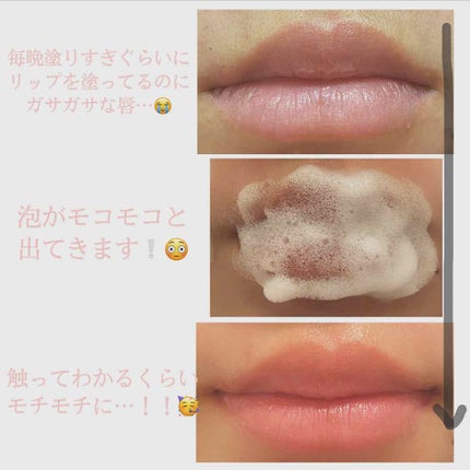 リップバブルパック/CHOOSY/リップマスクを使ったクチコミ(4枚目)
