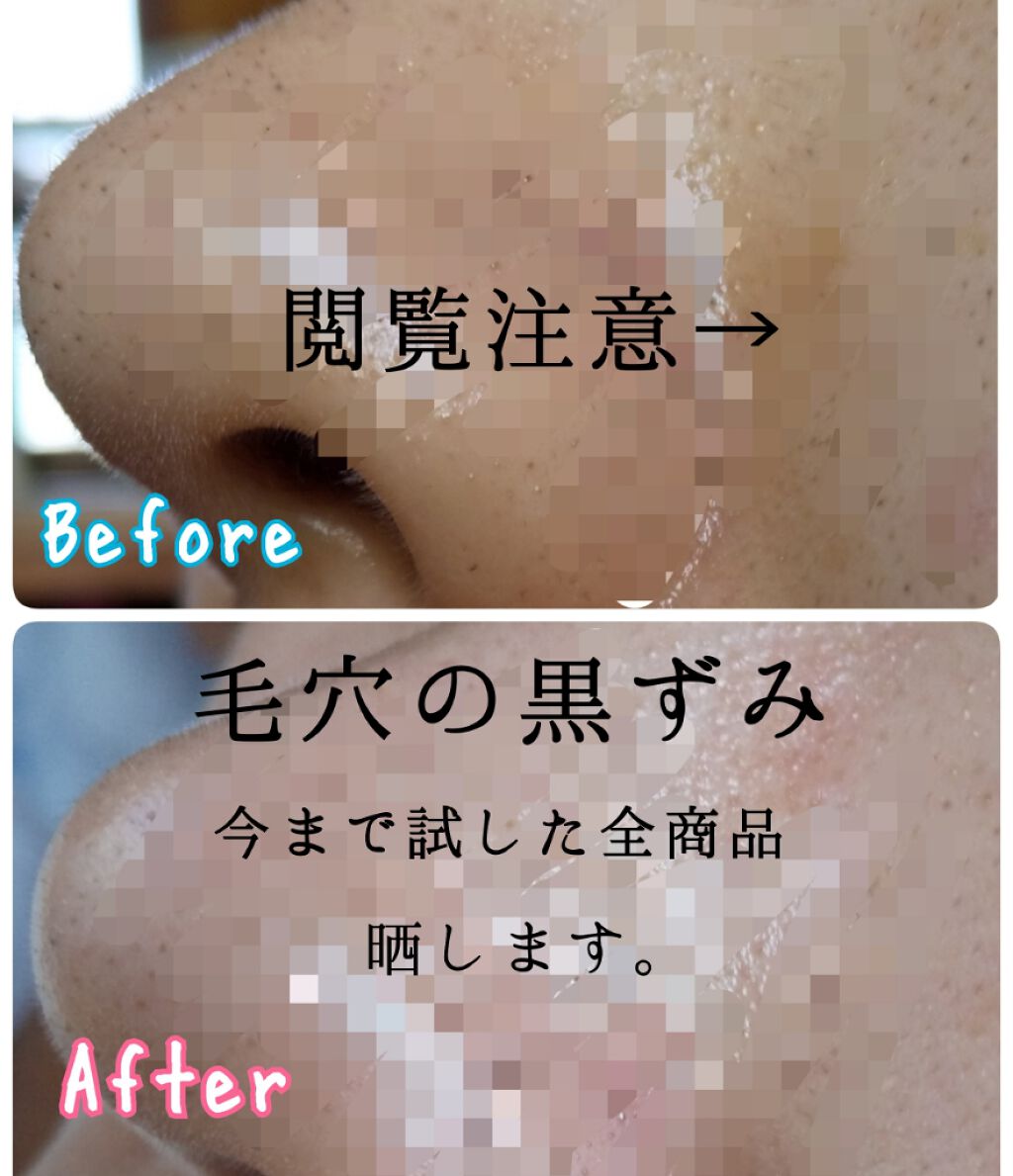 デュオ ザ クレンジングバーム クリア/DUO/クレンジングバームを使ったクチコミ(1枚目)