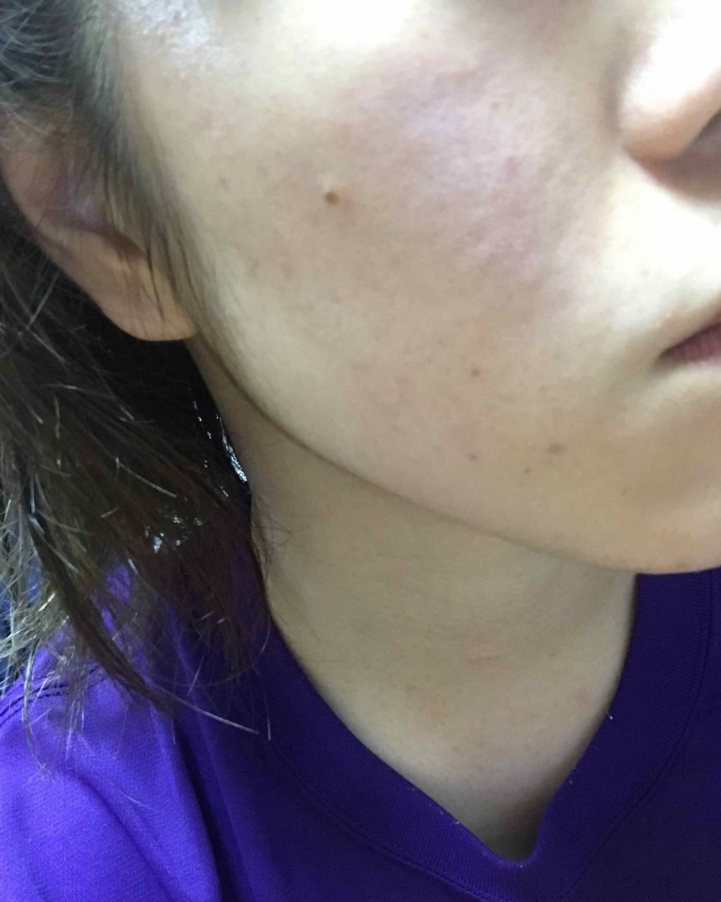 敏感肌用薬用美白美容液/無印良品/美容液を使ったクチコミ（3枚目）