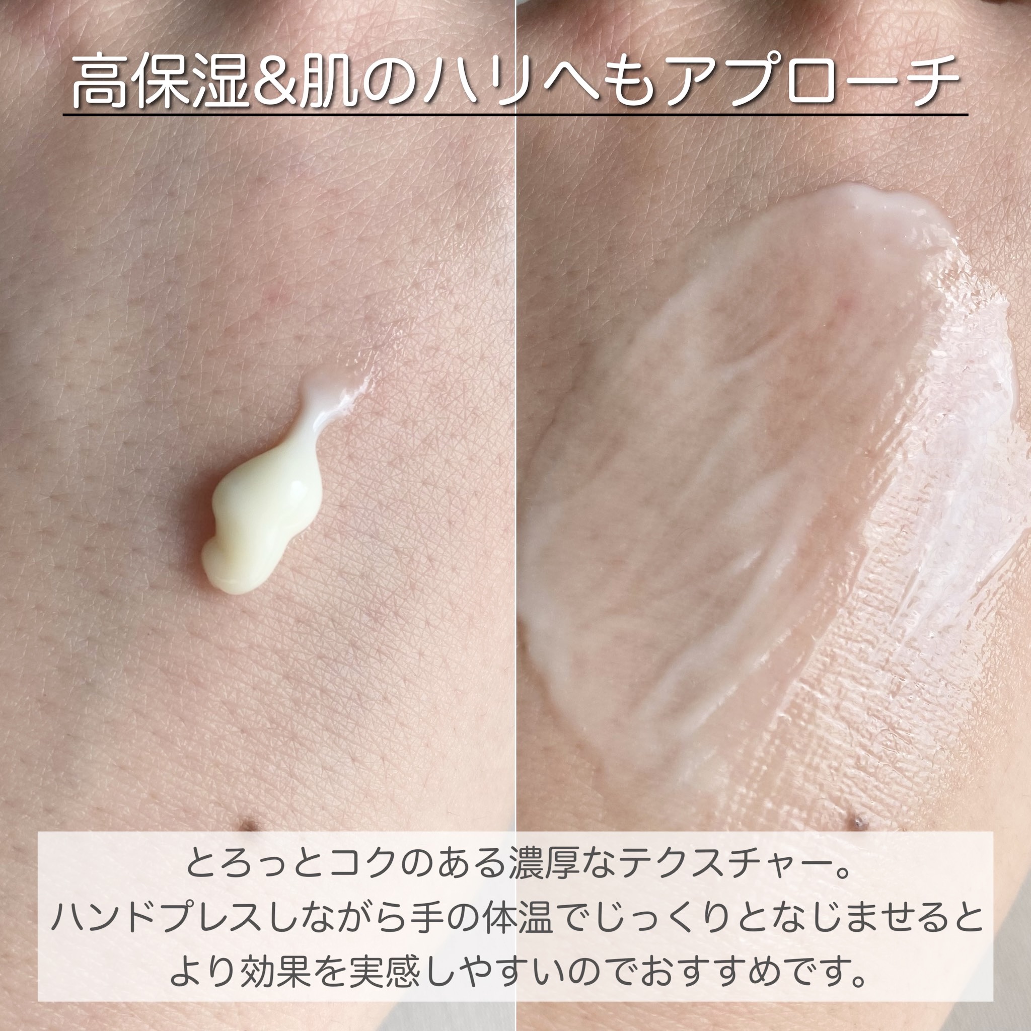 リフトホワイト パーフェクション/BRIGHTAGE/美容液を使ったクチコミ（2枚目）