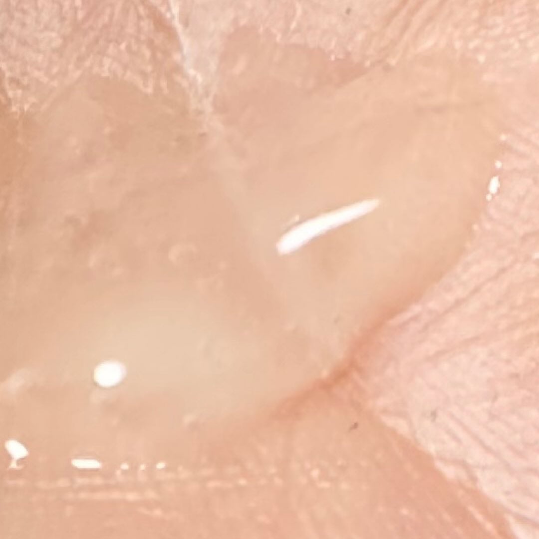 薬用 エフェクト リンクル&モイスト セラム/AMPULE SHOT/美容液を使ったクチコミ(5枚目)