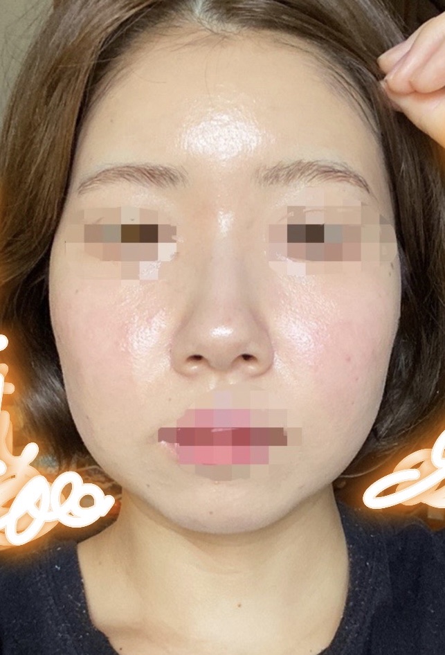 超高圧VC誘導体 クレンジングウォーター/matsukiyo/クレンジングウォーターを使ったクチコミ（1枚目）