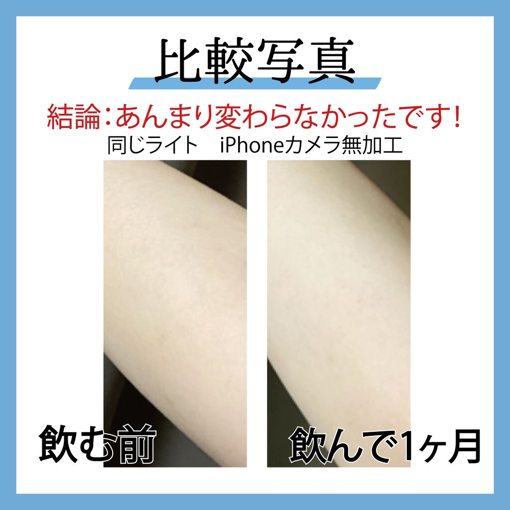 チョコラBB　ルーセントC（医薬品）/チョコラBB/その他を使ったクチコミ（2枚目）