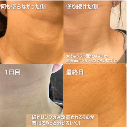 レチノパワー リンクルクリーム /エリクシール/アイケア・アイクリームを使ったクチコミ(9枚目)