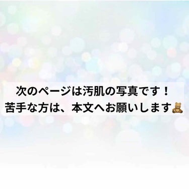 ハトムギ化粧水(ナチュリエ スキンコンディショナー R )/ナチュリエ/化粧水を使ったクチコミ（3枚目）