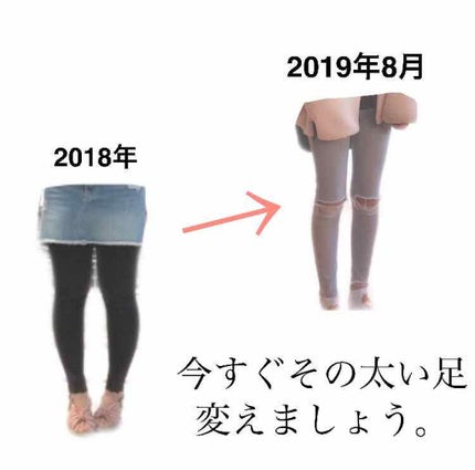 寝ながらメディキュット スパッツ 骨盤テーピング/メディキュット/着圧ソックス・レギンスを使ったクチコミ(1枚目)