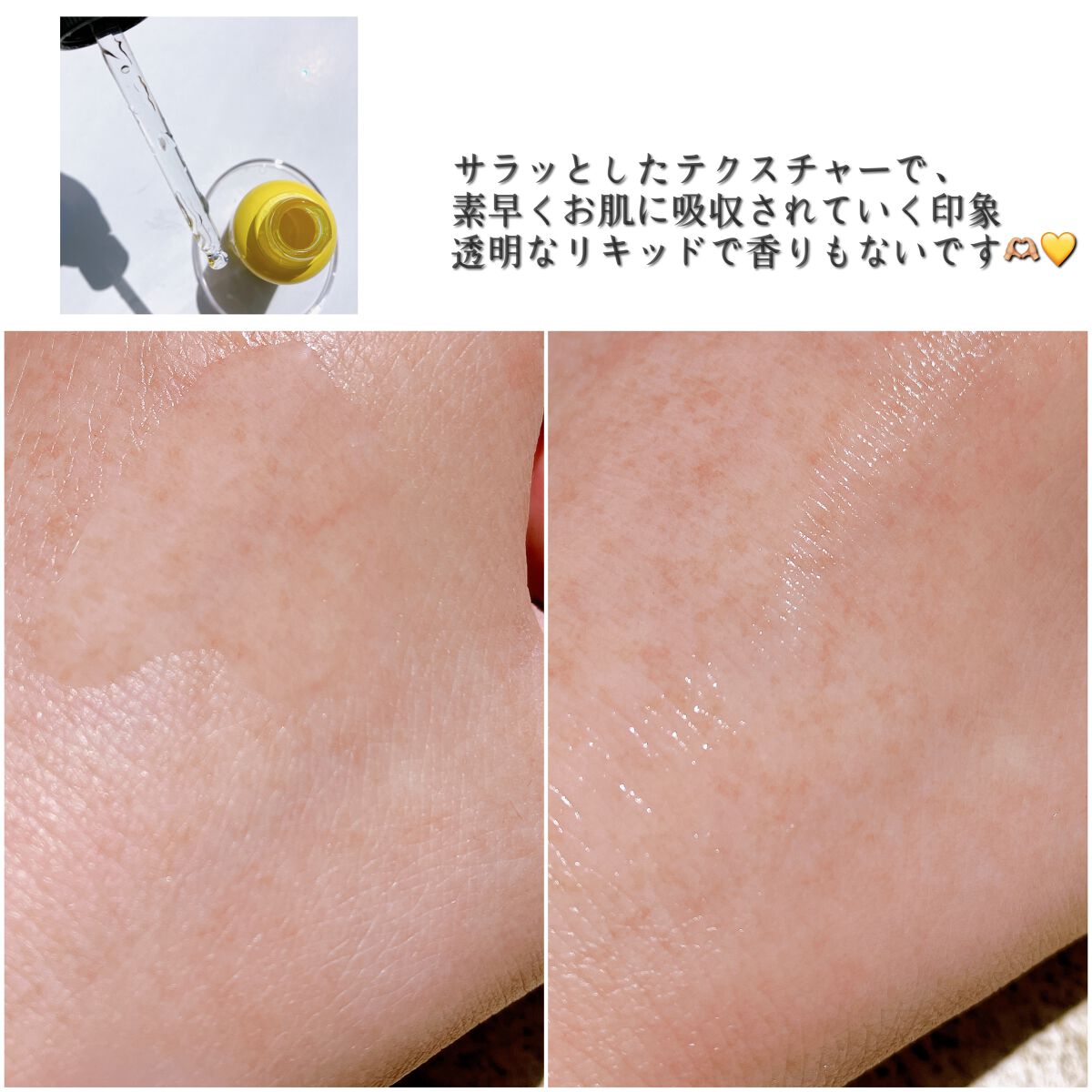 TIAM   ＶＢ３ソース/TIAM/美容液を使ったクチコミ（2枚目）