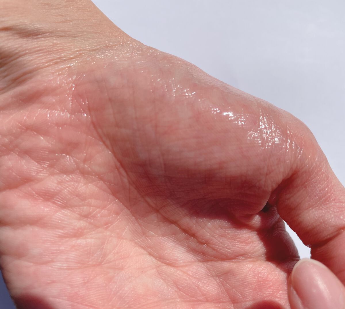 クラリフィック ブライトニング セラム/LANCOME/美容液を使ったクチコミ(5枚目)