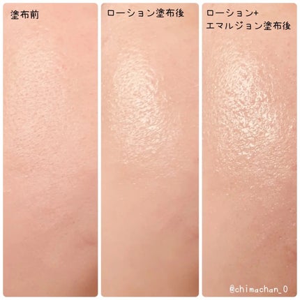 ドレススノー ローション【医薬部外品】 /アテニア/化粧水を使ったクチコミ(3枚目)