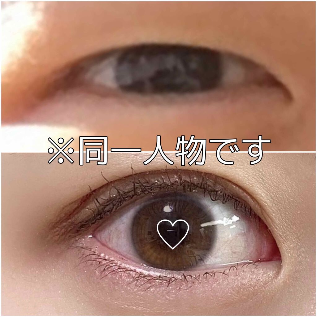 アイビューティー フィクサー WP/アストレア ヴィルゴ/二重まぶた用アイテムを使ったクチコミ(1枚目)
