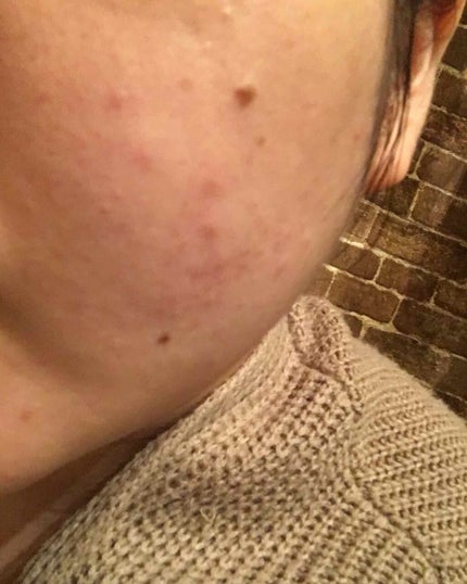 【旧】カプチュール トータル セル ENGY スーパー セラム/Dior/美容液を使ったクチコミ(2枚目)