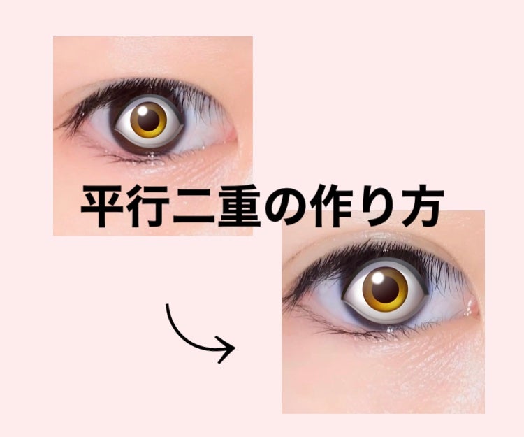 肌色タイプ/バンドエイド/その他を使ったクチコミ(1枚目)