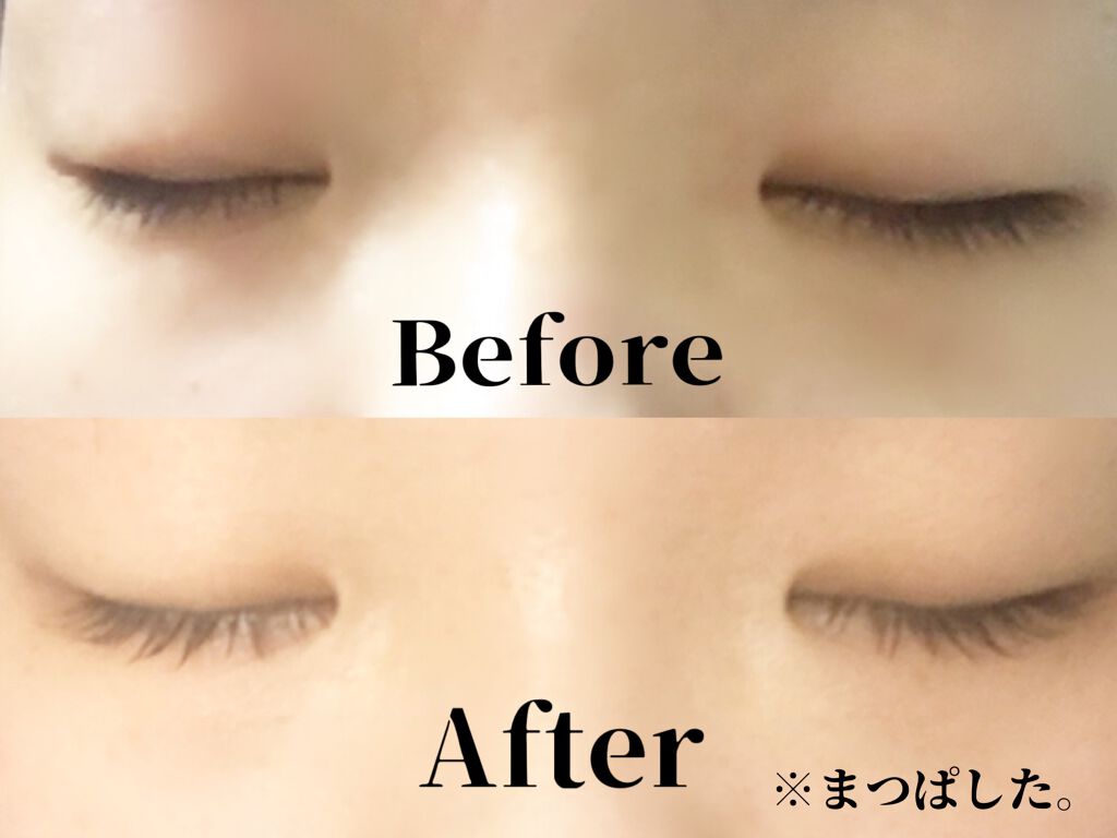スカルプD ボーテ ピュアフリーアイラッシュセラム　プレミアム/アンファー(スカルプD)/まつげ美容液を使ったクチコミ（1枚目）