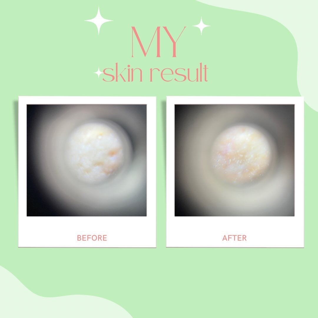 リードルショット300/VT/美容液を使ったクチコミ(5枚目)