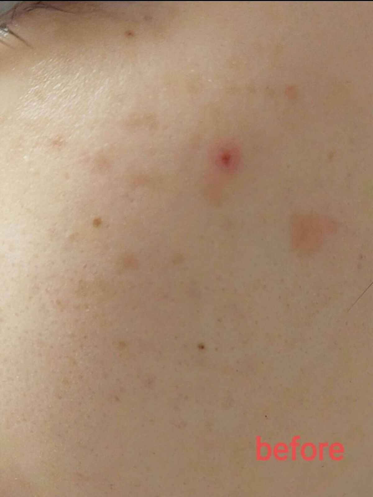 HQ White Cream/VELUS/美容液を使ったクチコミ（2枚目）